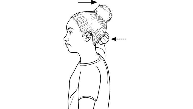 Neck strengthening (isometric extension)