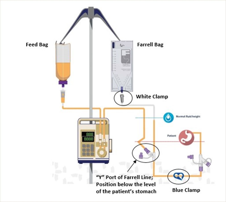Farrell Valve System
