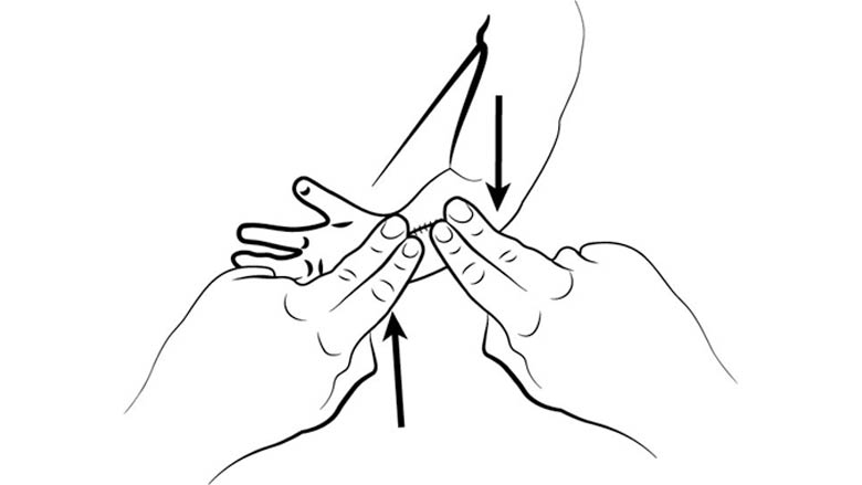 Scar Massage - Back and Forth, Up and Down