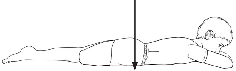 Strengthening: Above Knee Amputee Exercise Program - Gluteal sets