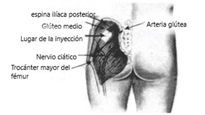 Instrucciones para administrar la inyección