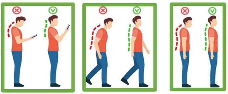 Joint Hypermobility - Walking