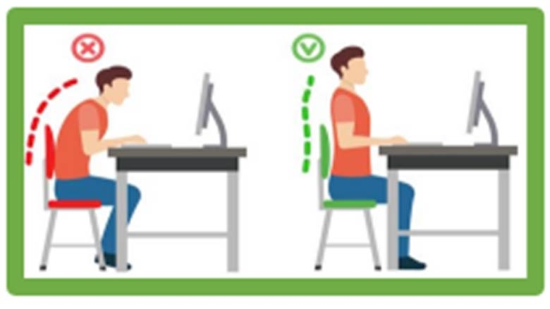 Joint Hypermobility - Computer